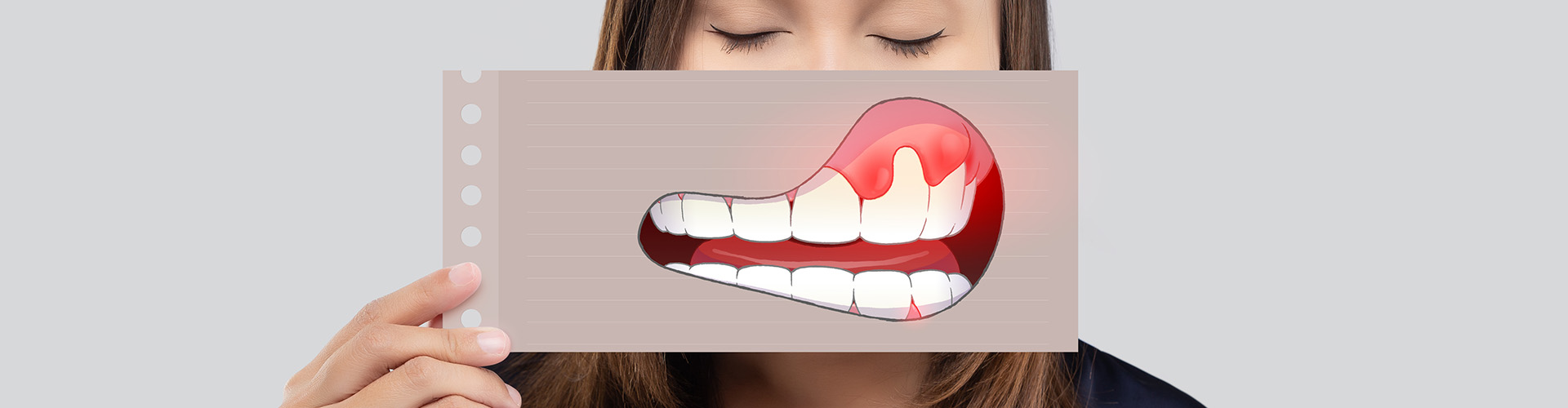 woman holding a drawing of inflamed gums in front of her mouth